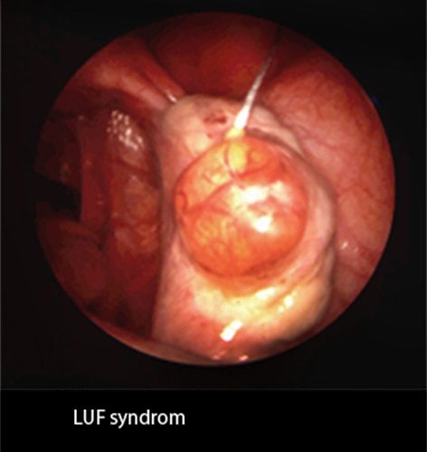 LUF-SD 3