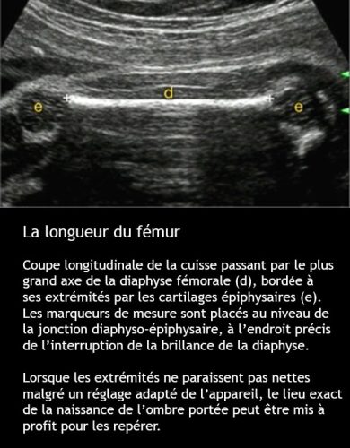 Longueur femur 1