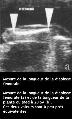 Longueur femur 2
