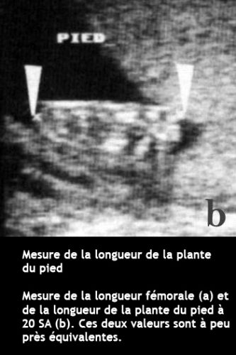 Longueur pied
