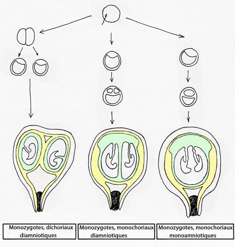 Monozygotes