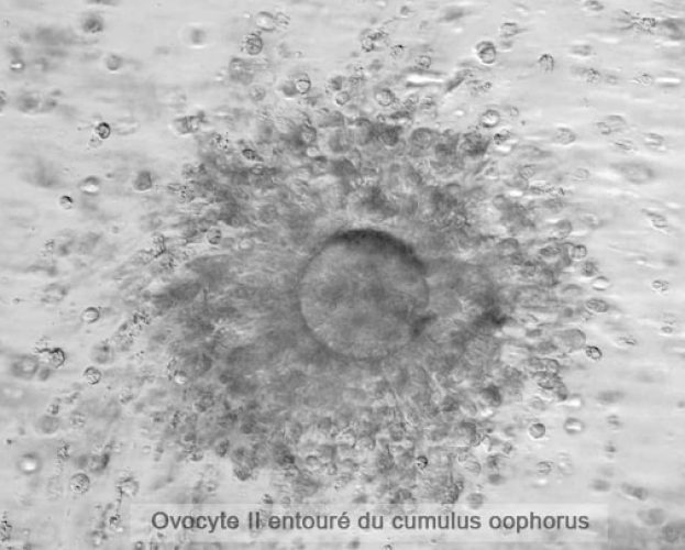 Ovocyte II bis — structure zona pellucida et globule polaire