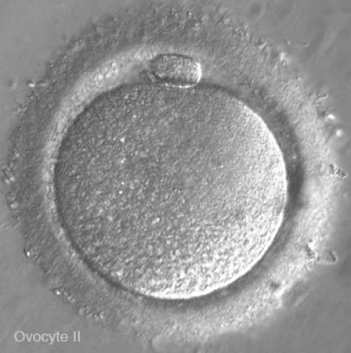 Ovocyte II — ovule mature prêt pour la fécondation