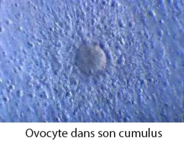 Ovocyte dans son cumulus
