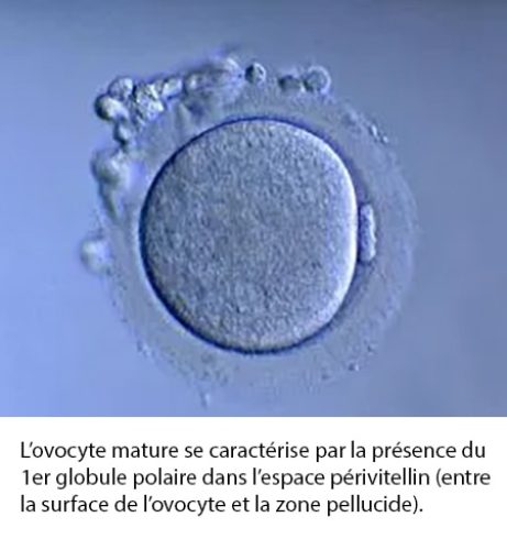 Ovocyte mature