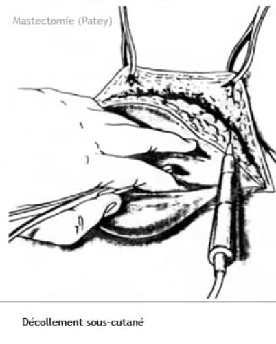 Patey 2