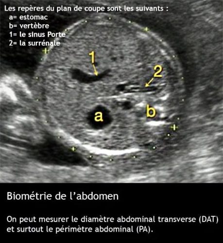 Perimetre abdominal 2