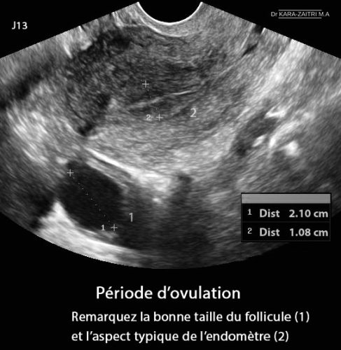 Periode ovulation