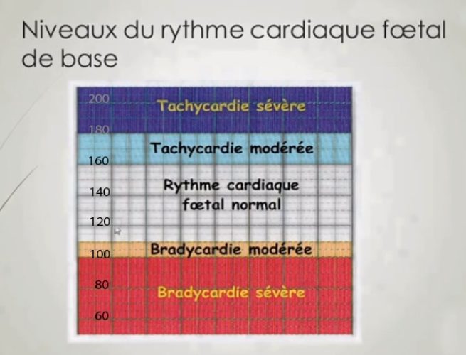 RCF rythmes de base — classification cardiotocographique normale et pathologique