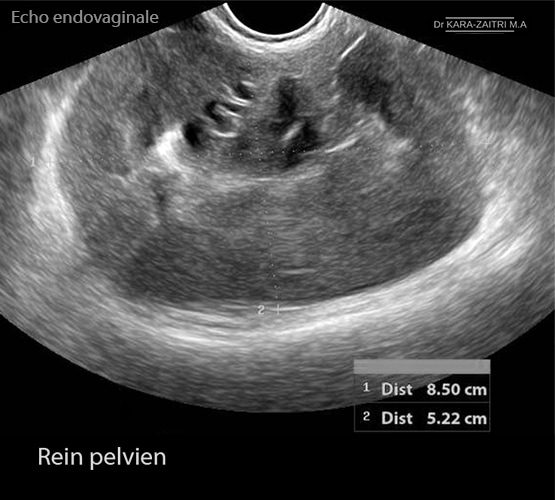 Rein pelvien 2