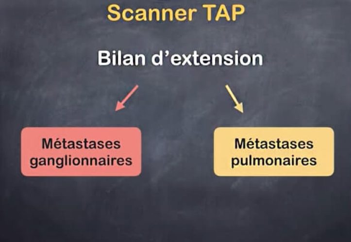 TAP