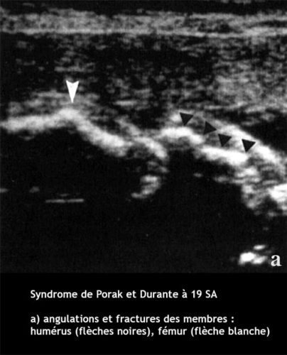Sd de Porak_Durante 1