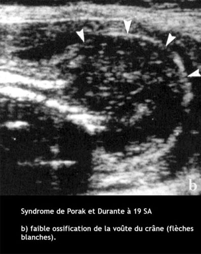 Sd de Porak_Durante 2