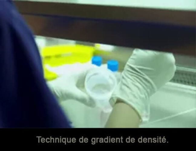 Sperme_gradient_densite