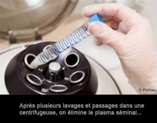 Sperme_lavage