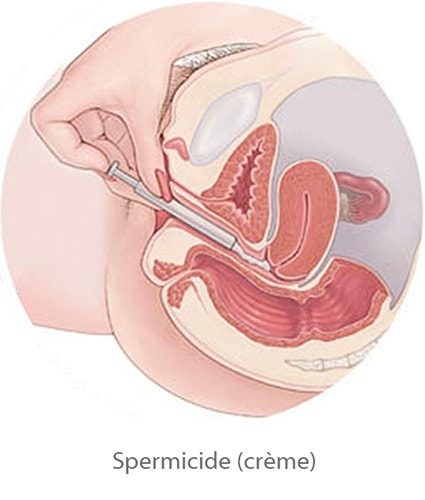 spermicides