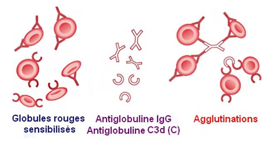TDA 1