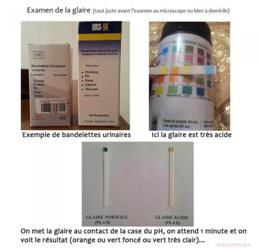 Test post-coïtal TPC — test de Hühner glaire cervicale spermatozoïdes 4