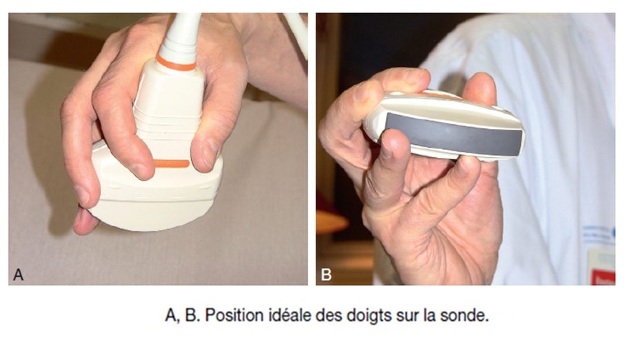 Tenir la sonde échographique — technique position main opérateur