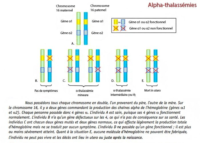 Thalassemie 2