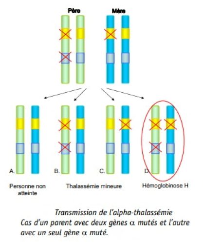Thalassemie 3