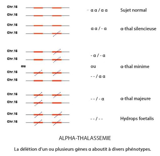 Thalassemie 5