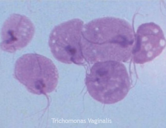 Trichomonas 2