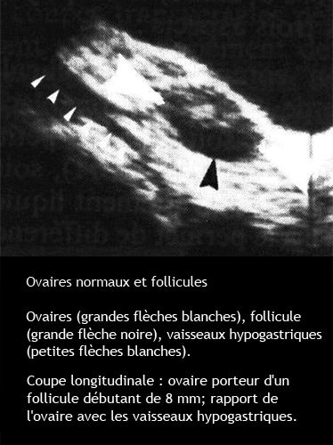 Vaisseaux pelviens 2