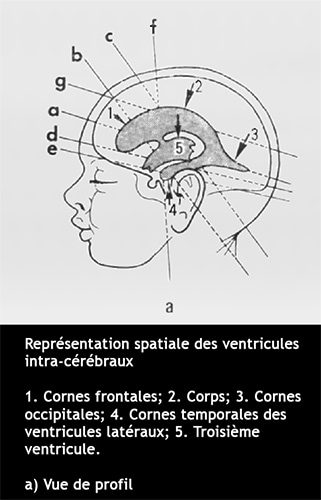 Ventricules cerebraux 1