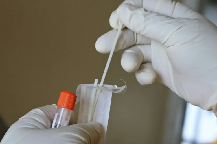 Bilan de dépistage des IST — tubes de prélèvement pcr.