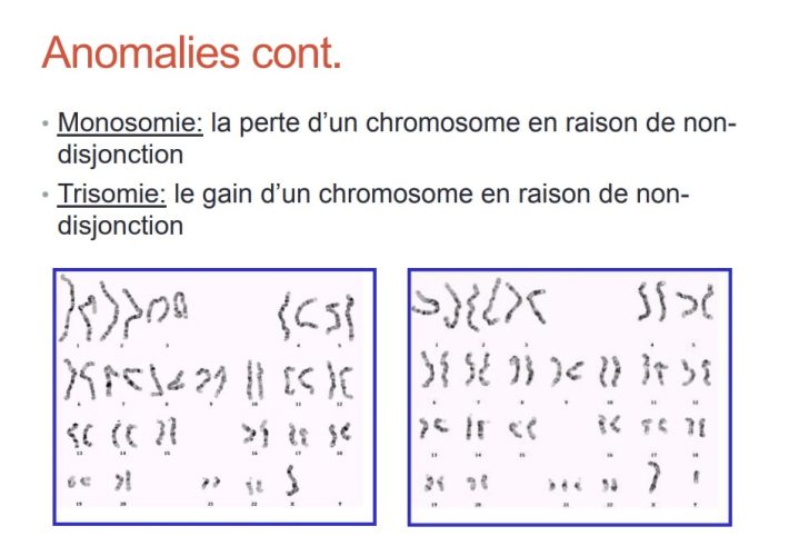 Anomalies chromosomiques — types mutations structurelles et numériques