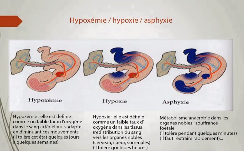 Hypoxémie hypoxie asphyxie fœtale — physiopathologie souffrance fœtale